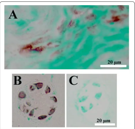 Figure 5 Representative images showing immunohistochemicallocalization of RANKL in the human disc