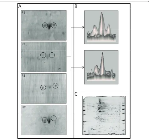 Figure 5 Serum IgG reactivity to vinculin in serum of patients with giant cell arteritis