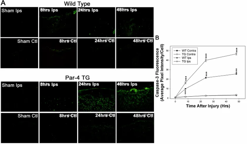 Figure 6 Caspase-3 activation is significantly greater in transgenic mice that overexpress Par-4 compared to wild-type mice