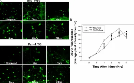 Figure 4 Par-4 overexpression in cortical neurons facilitates an earlier activation of caspase-3, contributing to a quicker progression through cell death