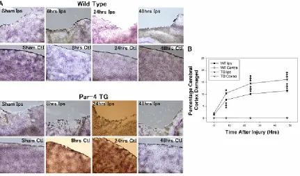 Figure 5 Traumatic brain injury is exacerbated in Par-4 transgenic mice compared to wild-type mice