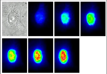 Figure 2 A transmission and the consecutive fluorescent images of a PtK2 cell injected with a βmRNA MB at 3-minute intervals for 18 minutes