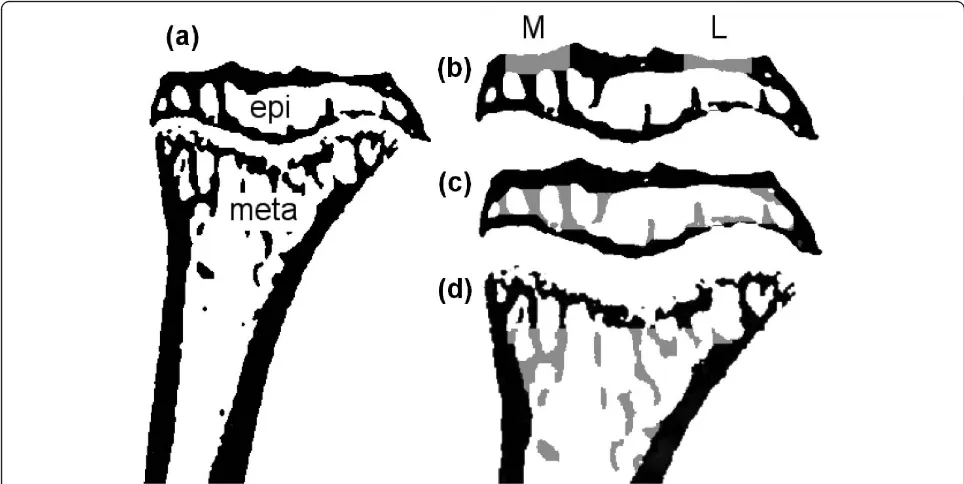 Figure 1 Regions that were analyzed using micro-CTgrey.. (a) Cross-sectional image of proximal tibia, including epiphysis (epi) and metaphysis(meta)