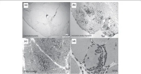 Figure 1. Diff ering pathologies in myositis subtypes. The distribution of immune system cells diff ers among myositis subtypes