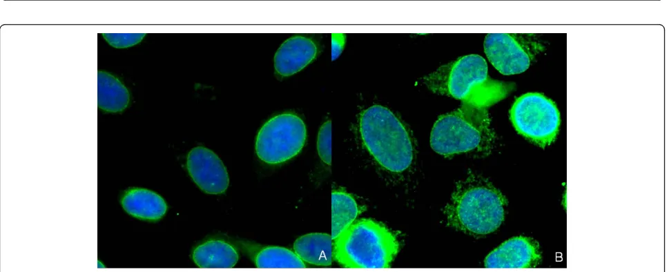 Figure 2 Immunofluorescence patterns of two sera (a, b) which were both scored as negative by visual examination butdemonstrated positive cytoplasmic staining by AKLIDES® system