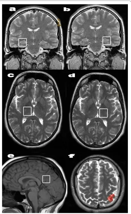 Figure 1 Voxel placement in the different brain regionsotor pocampus . The hip-(a, b), thalamus (c, d), posterior gyrus (e), and left sensorim-(f) (red) after functional magnetic resonance imaging during finger-tapping tasks.