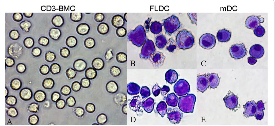 Figure 1 SLE BMDCs cultured with FL alone (FLDCs) or GM - CSF + IL-4 (mDCs)May-Grunwald-Giemsa-stained cytospin preparations of immature FLDCs bone marrow-derived dendritic cells; CD3