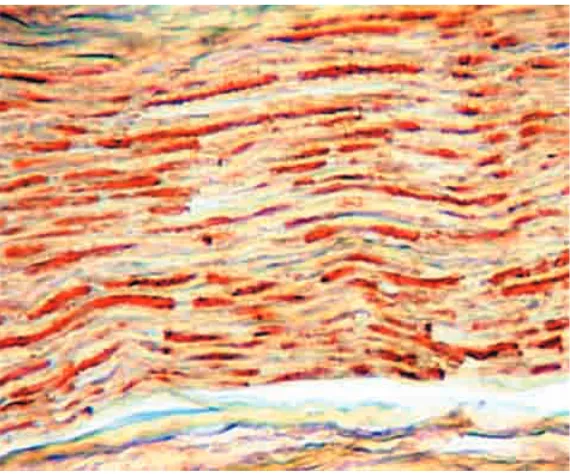 Fig. 1: Normal peripheral nerve bundle. Picture taken in the Group I.Thin section stained with HE (larger magnification) demonstrates the peripheral nerve fascicle, located in the dermis co-rium