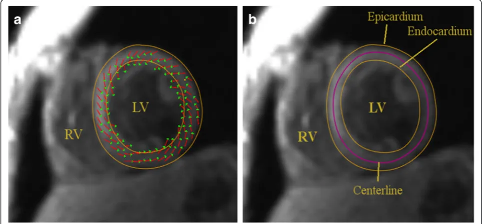Fig. 2 a Myocardial contours enclosing the local myocardial velocity field (planar components) for base slice in early systolic phase