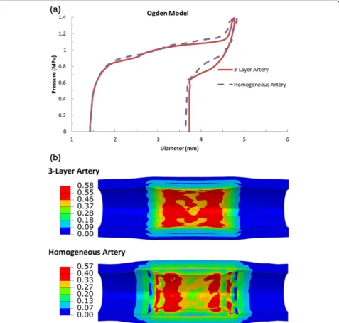 Figure 10 Comparison of (a) diameter change for the stent and (b) von Mises stress distribution in the artery-plaque system for3-layer and homogeneous artery models.