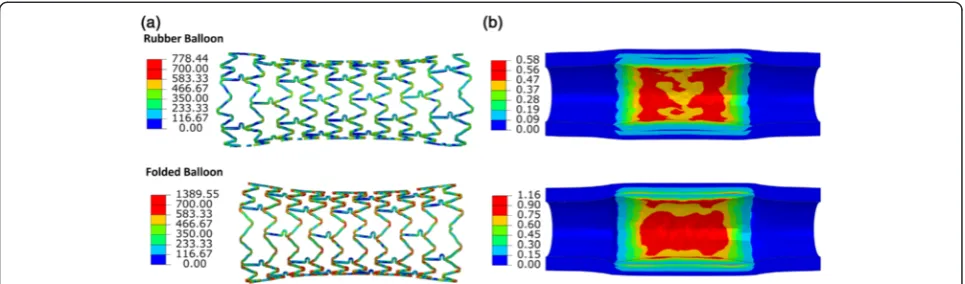 Figure 6 Contour plot of von Mises stress in (a) the stent and (b) the artery-plaque system for simulations using rubber balloon and3-folded balloon.