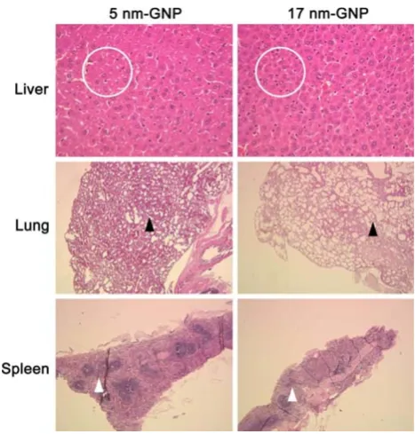 Fig. 3 H&E staining showed GNP-induced abnormality in majororgans. (Top to bottom) HE staining for liver, lung, and spleen