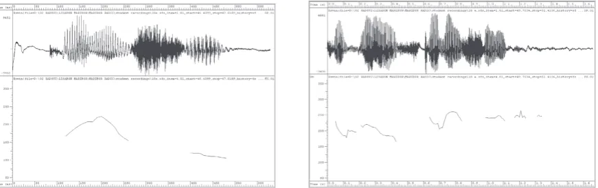 Figure 5: F0 tracks of the TU ‘...����������������������������������couldn't she’������������� produced with a falling (student No 11) and an ��������������������������������������������������������������������������������������������