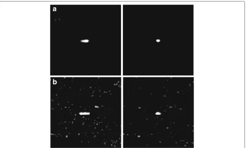 Fig. 8 Comparison of the two-step MOCO-based imaging algorithm and one-step MOCO-based imaging algorithm in local amplification results ofon thescene 1 and scene 2