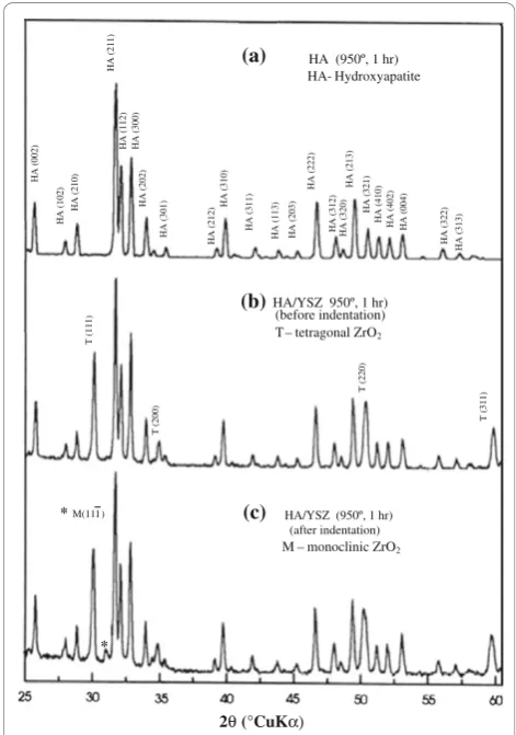Figure 3 (a) XRD patterns of HA and YSZ/HA powder, with Ca/P ratio of 1,67 and YSZ content of 10%, heated at 950°C, 1 hin water vapor atmosphere, before indentation (b) and afterindentation (c).