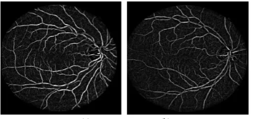 Figure 6. Combined  results of false edge removal using morphological opening by reconstruction and guided  filtering for images 02 and 10 of DRIVE database
