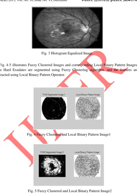 Fig. 3 Histogram Equalized Image 