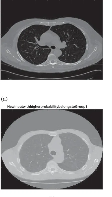 Figure 3. Lung Cancer detected using entropy degradation method (EDM) algorithm: (a) One new input is detected to Group 0 (i.e
