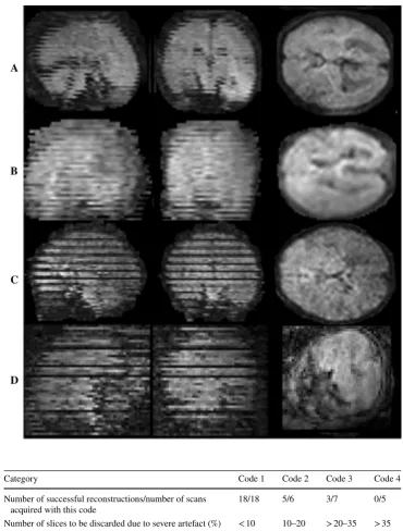 Fig. 2  Classification of fetal data. Example illustrating the classification of fetal data according to the fraction of slices showing signal dropout or other artefacts likely to be caused by motion (see Table for definitions)