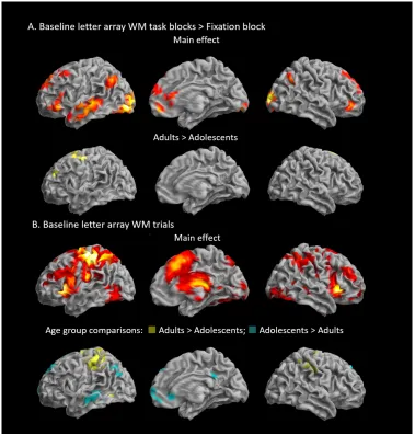 Figure 3: Letter working memory task activation and age group differences in the absence of reward