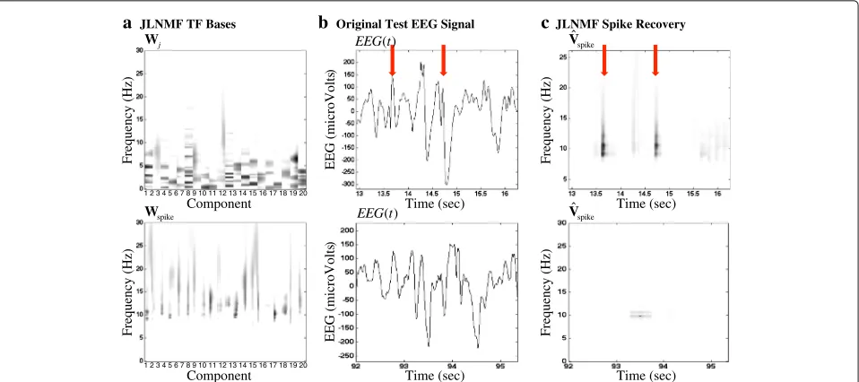 Fig. 10 NMF decomposed TF bases for NS and PS classes