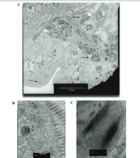 Figure 3 The absorption of SWCNTs through intestinal columnar epithelial cellsmembrane