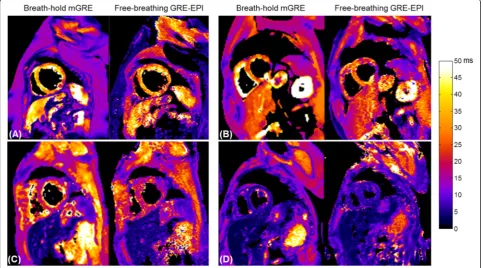 Fig. 3 Representative examples of T2* maps in four patients (a–d) acquired using breath-hold MGRE and free-breathing MOCO GRE-EPI