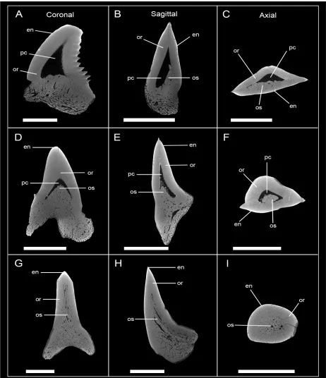 Fig 8. Micro-CT images of tooth sections of different developmental stages in †Hemipristisserra in frontal, sagittal and axial view