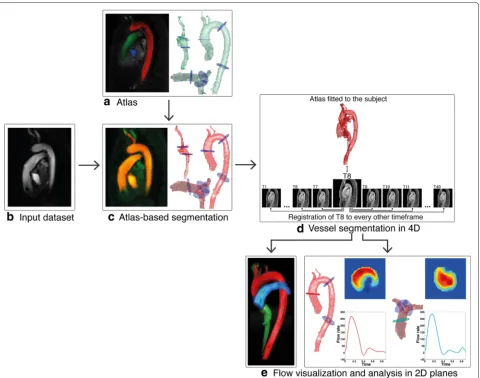 Fig. 2 Atlas creation process.thresholding the PC-MRA. a A PC-MRA is created from the time frames in systole