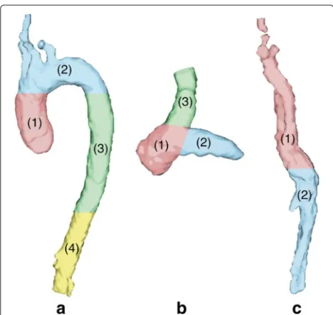Fig. 7 Resulting segmentation in systole. Near sagittal (a, c) and transverse (b, d) views of the segmentation of the great thoracic vessels