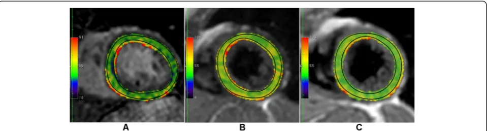 Fig. 2 Exemplary T2-maps acquired with the three different T2-mapping sequences. Set of T2 maps in a midventricular slice of the same healthyvolunteer, acquired with the three different sequences T2prep (a), GraSE (b) and MESE (c)
