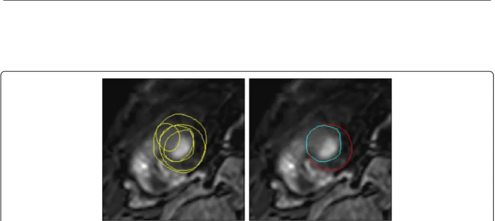 Fig. 4 An example of the automatically generated report visualizing the similarity between a reader (green) and consensus (red) contours.Magenta bands indicate the range of contour positions for all seven readers