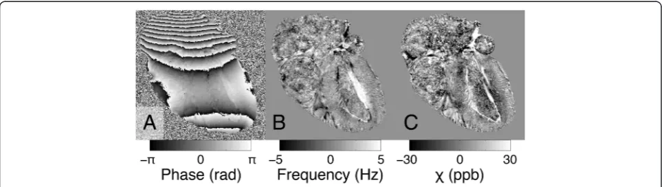 Fig. 2 Reconstruction pipeline for processing the magnetic susceptibility of the mouse heart specimens