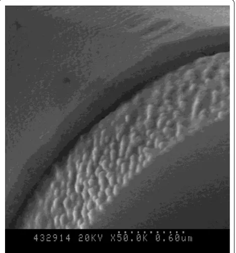 Figure 3 SEM morphologies of thecoated by gelatin b-TCP scaffold surface.