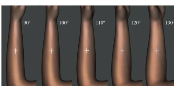 Figure 4.Skew of the grid in the supinated posture. The center of the supinated forearm was marked as perprocedure used for the grid-drawing on the pronated forearm