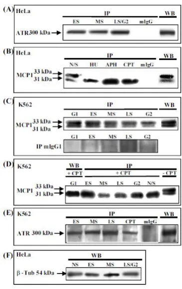 FIG I: (A) Immunoprecipitation (IP) with anti-MCP1 antibody, followed by western blot with anti-ATR antibody detected the ATR protein, in nuclear extracts from HeLa cells, which were 