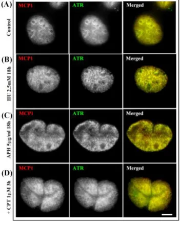 FIG II: Immunofluorescence of MCP1 (red) and ATR (green) proteins in human control MO59K cells (A), and in MO59K cells treated with 2.5mM hydroxyurea (B), with 5g/ml aphidicolin for 