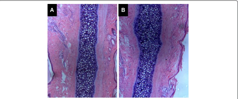 Figure 6 Histopathological sections of rabbit ears after intravenous administration of (A) DHA N/O/W emulsion and (B) Sodiumchloride injection.