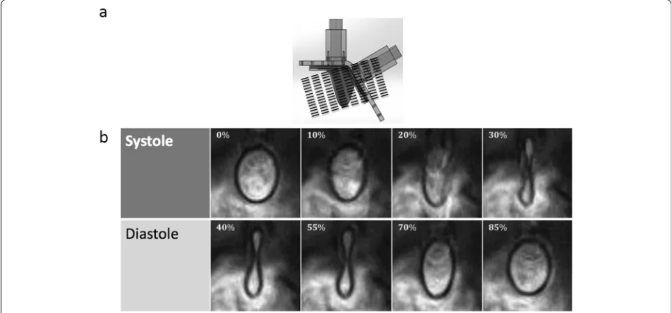 Fig. 5 Cine-CMR measurements of the LV physical model wall motion: (a) shows the orientation of the 15 planes (or short axis slices) used foracquiring anatomical cine-CMR images for quantifying wall motion, and (b) shows representative images across both s