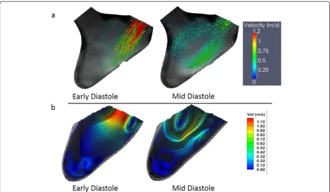 Fig. 7 DPIV and PC-CMR measurements on the LV physical model during the early and mid-diastolic phases of the cardiac cycle: (a) PC-CMR velocityvectors (b) DPIV streamlines colored with velocity magnitudes.