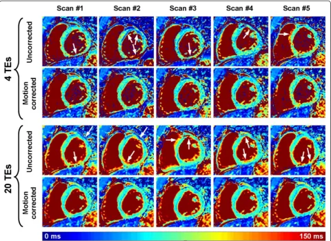 Fig. 3 Example of multiple T2 maps acquired on the same subject using the T2P20TE sequence acquired under free breathing conditionswith respiratory navigator gating