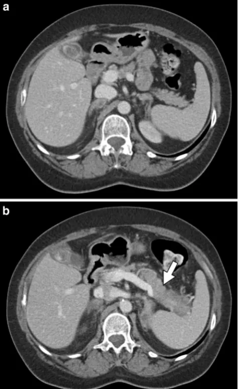 Fig. 6 A 59-year-old female patient with stage IV non-small cell lung