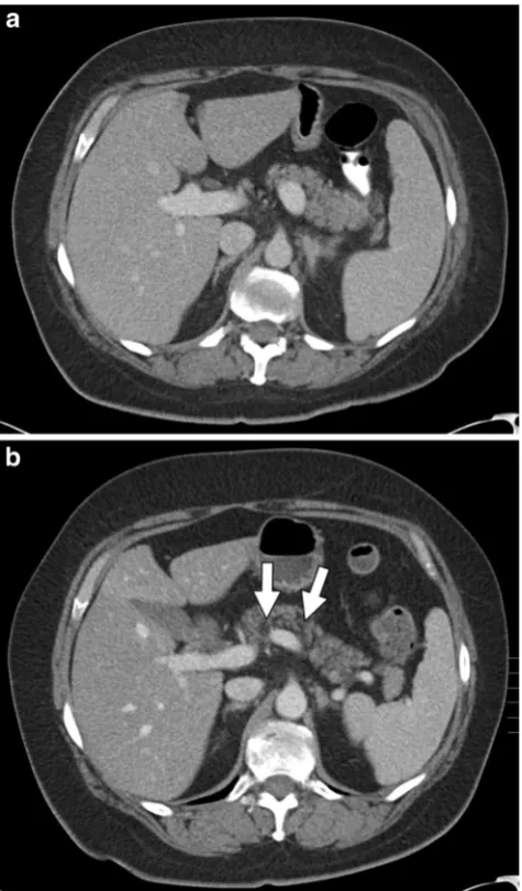 Fig. 7 An 11-year-old male withacute lymphoblastic leukaemia oncombination therapy that includesL-asparaginase