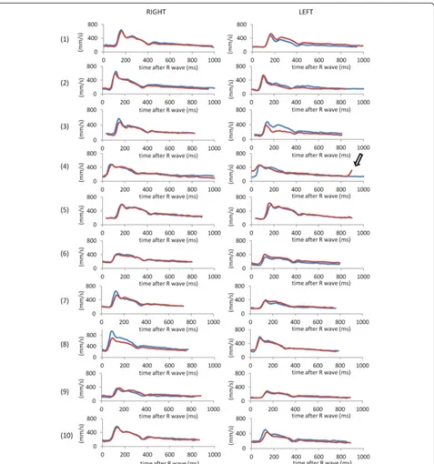 Figure 3 Velocity-time curves in the initial (blue) and repeat (red) scanning sessions in all 10 subjects, as determined by observer 1.In the repeat left acquisition in subject 4, a much reduced RR interval (895 ms vs 1095 ms) and ECG mis-triggering (open 