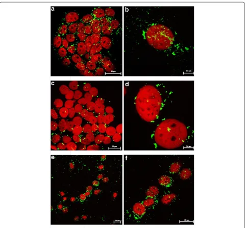 Figure 5 Cellular uptake of particles as studied by confocal fluorescence microscopy. Cellular uptake of uncoated rods (a and b) andspheres (c and d) vs PEI-functionalized S-MSPs (e and f) (spheres) in HeLa cells after 4 h incubation, resulting in differen