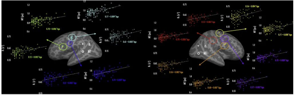 Fig. 3. Results of age-MPM correlations. Maps present vertices where positive age-parameter correlations (jackknifed) were signicoef(b) Signiand thickness, and MPM cohort (see Materials and Methods)