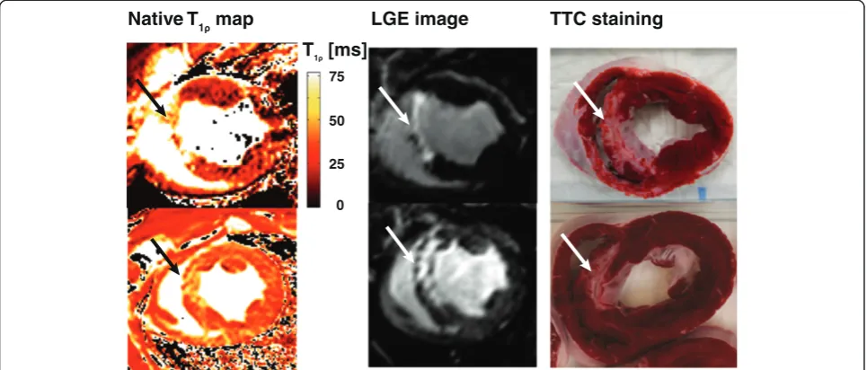 Figure 4 T1ρ dispersion measured in ex vivo porcine hearts (n = 5) 8 weeks after MI. Errorbars indicate standard deviation.