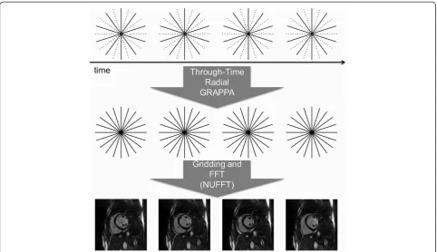 Figure 1 A schematic of the reconstruction pipeline for real-time imaging with radial GRAPPA
