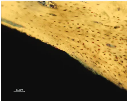 Figure 4:  Implant material Resilon after 12 weeks