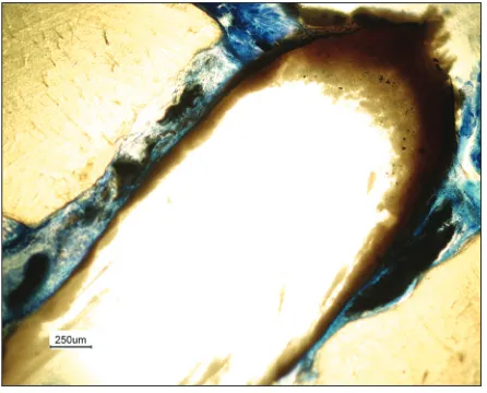 Figure 6: Implant materials Resilon+Epiphany after 12 weeks